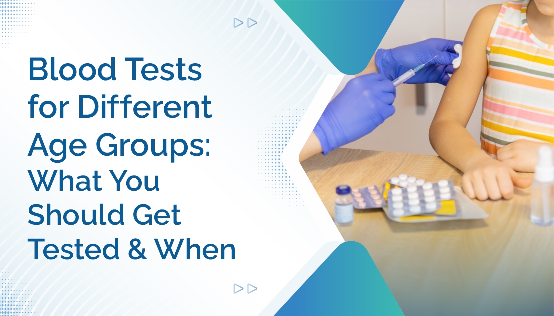 Blood Tests for Different Age Groups: What You Should Get Tested and When